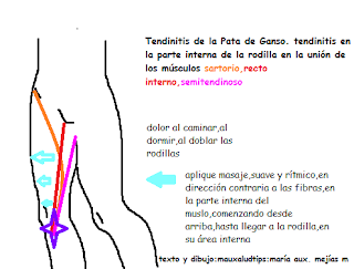 Dolor en parte interna del muslo